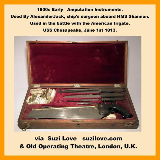 1800s Early Amputation Instruments used by Alexander Jack in the early 1800s. Jack was a ship's surgeon aboard H.M.S. Shannon and used by him in the battle between the Shannon & the American frigate the USS Chesapeake on June 1st, 1813, during the War of 1812. via Old Operating Theatre, London.